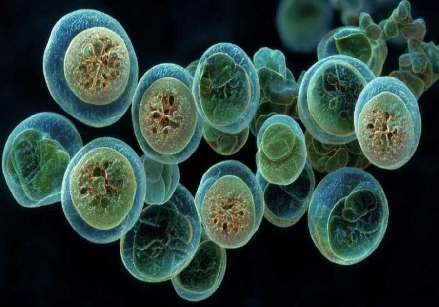 CDC, FDA say Cyclospora outbreak much more prevalent that initially assumed